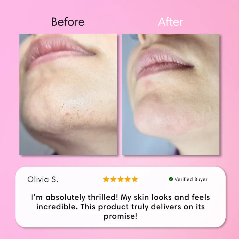 Rhenford - Facial Hair Removal Kit