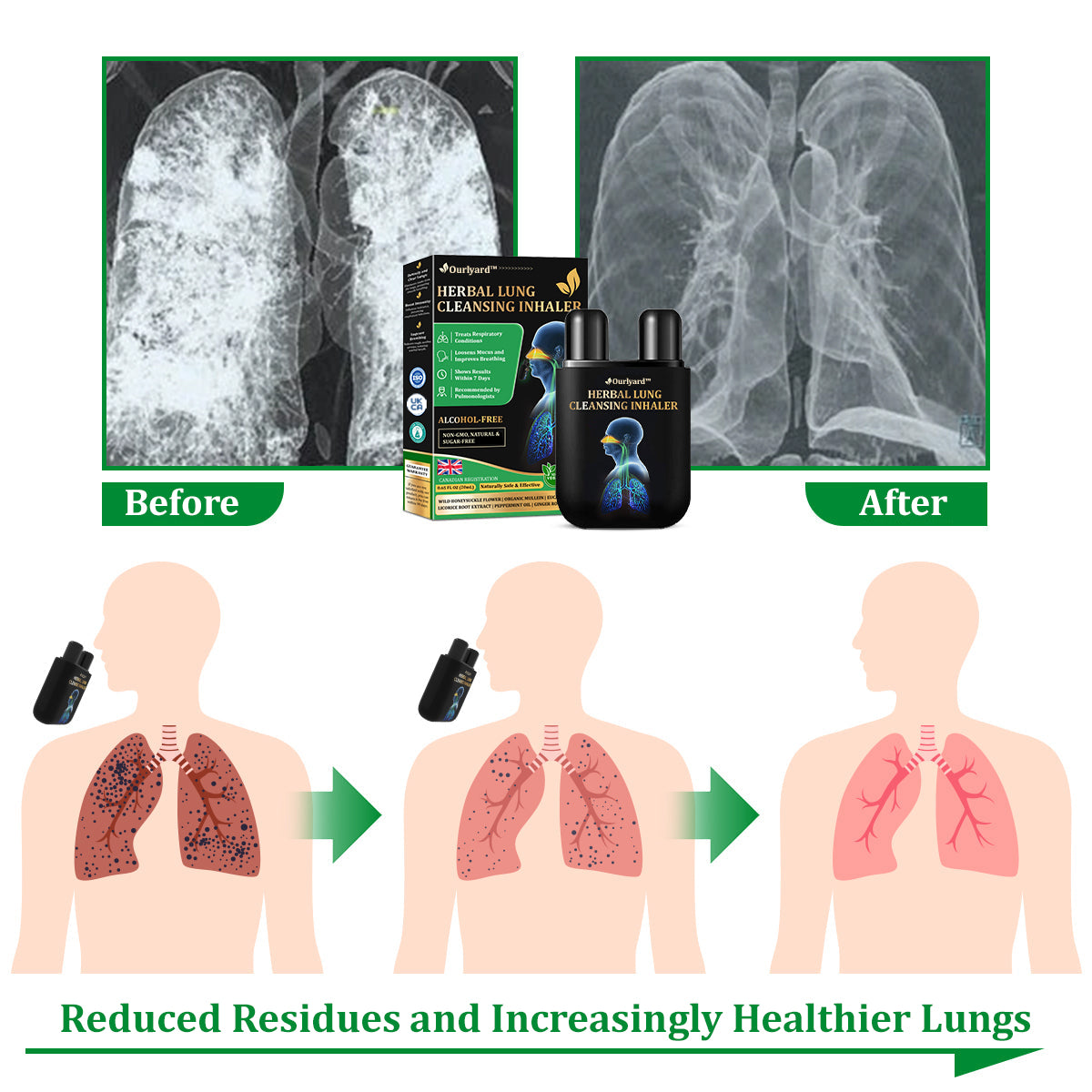 Ourlyard™ Herbal Lung Cleansing Inhaler
