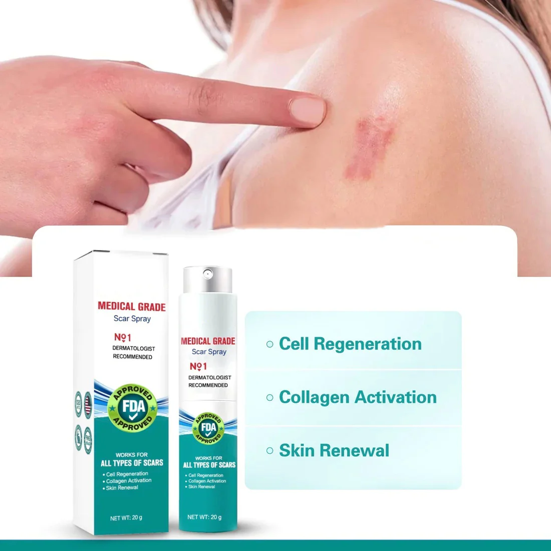 ❤️Advanced Scar Spray For All Types of Scars