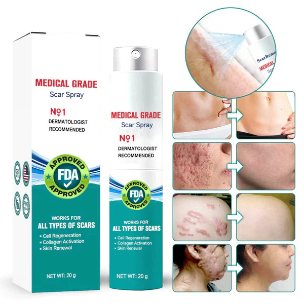 ❤️Advanced Scar Spray For All Types of Scars