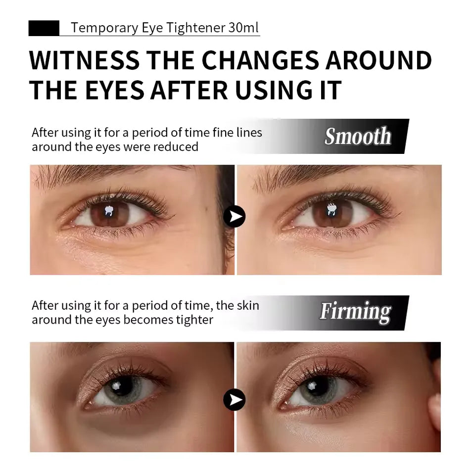 Temporary Face Tightener
